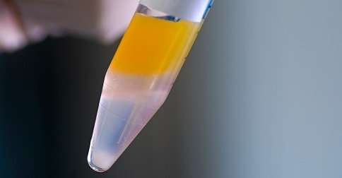 La inseminación artificial en 8 pasos