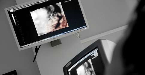 ¿Se puede ver la endometriosis en la ecografía?