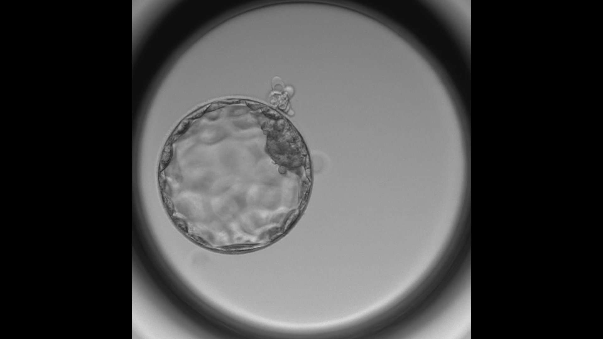 embryoGERI