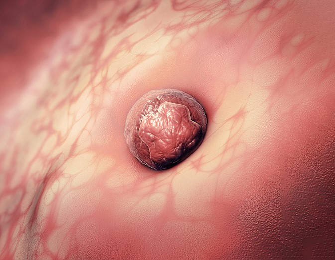 Embrión_Fallos de implantación_Tambre_